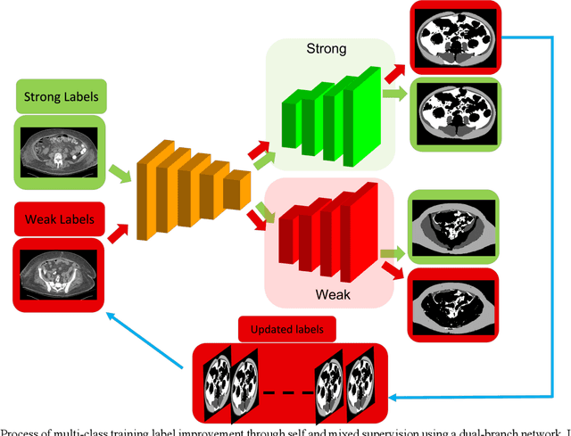 Figure 1 for Self and Mixed Supervision to Improve Training Labels for Multi-Class Medical Image Segmentation