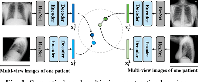 Figure 1 for MvCo-DoT:Multi-View Contrastive Domain Transfer Network for Medical Report Generation