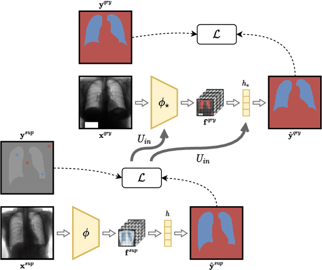 Figure 3 for Meta-Learners for Few-Shot Weakly-Supervised Medical Image Segmentation