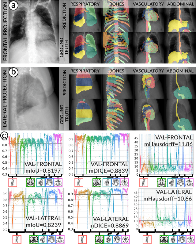 Figure 3 for Accurate Fine-Grained Segmentation of Human Anatomy in Radiographs via Volumetric Pseudo-Labeling