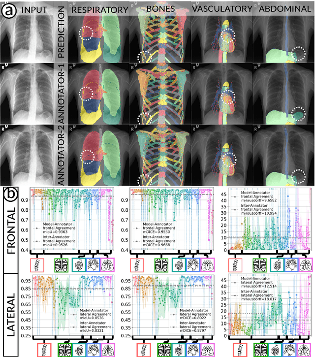Figure 4 for Accurate Fine-Grained Segmentation of Human Anatomy in Radiographs via Volumetric Pseudo-Labeling