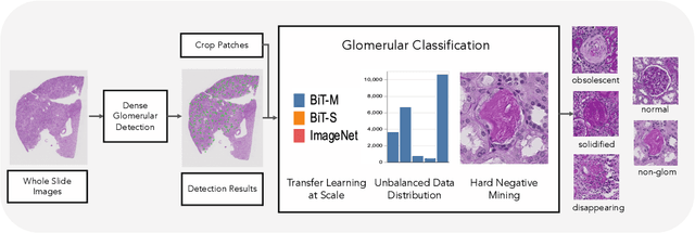 Figure 2 for Holistic Fine-grained GGS Characterization: From Detection to Unbalanced Classification