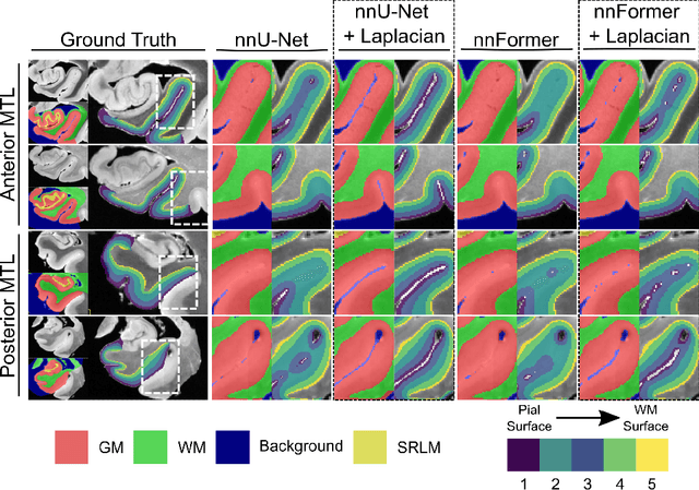 Figure 3 for Improved Segmentation of Deep Sulci in Cortical Gray Matter Using a Deep Learning Framework Incorporating Laplace's Equation