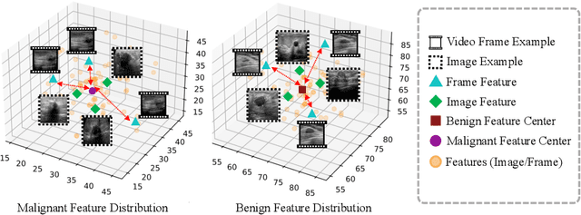 Figure 1 for Boosting Breast Ultrasound Video Classification by the Guidance of Keyframe Feature Centers