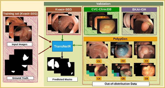 Figure 1 for TransNetR: Transformer-based Residual Network for Polyp Segmentation with Multi-Center Out-of-Distribution Testing