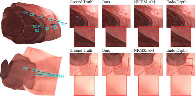 Figure 1 for EndoGSLAM: Real-Time Dense Reconstruction and Tracking in Endoscopic Surgeries using Gaussian Splatting
