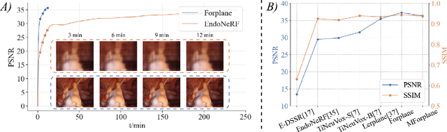 Figure 1 for Efficient Deformable Tissue Reconstruction via Orthogonal Neural Plane