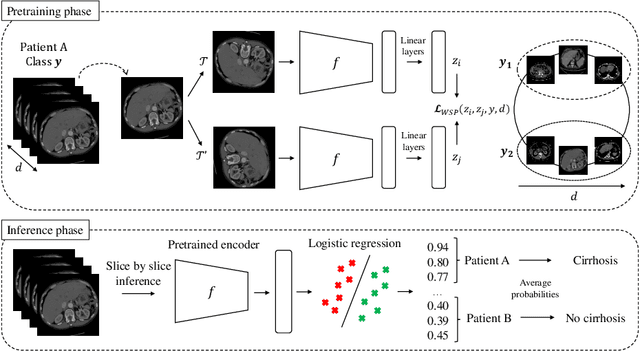 Figure 4 for Weakly-supervised positional contrastive learning: application to cirrhosis classification