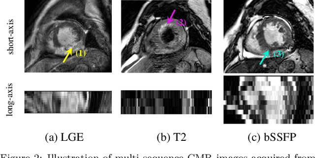 Figure 3 for Cardiac Segmentation on Late Gadolinium Enhancement MRI: A Benchmark Study from Multi-Sequence Cardiac MR Segmentation Challenge