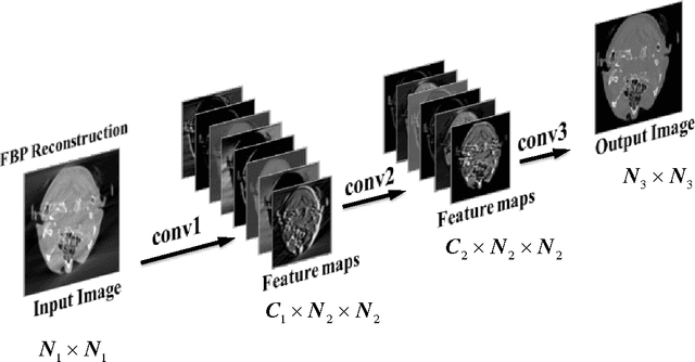 Figure 3 for Image Prediction for Limited-angle Tomography via Deep Learning with Convolutional Neural Network