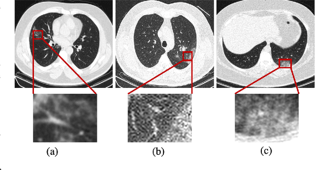 Figure 2 for Diagnosis/Prognosis of COVID-19 Images: Challenges, Opportunities, and Applications