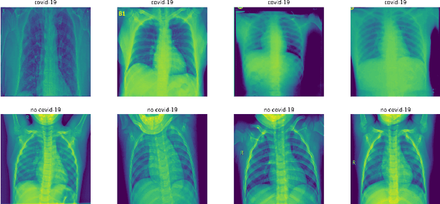 Figure 1 for Clustering COVID-19 Lung Scans