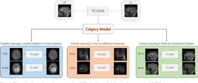 Figure 3 for Transfer Learning Enhanced Generative Adversarial Networks for Multi-Channel MRI Reconstruction