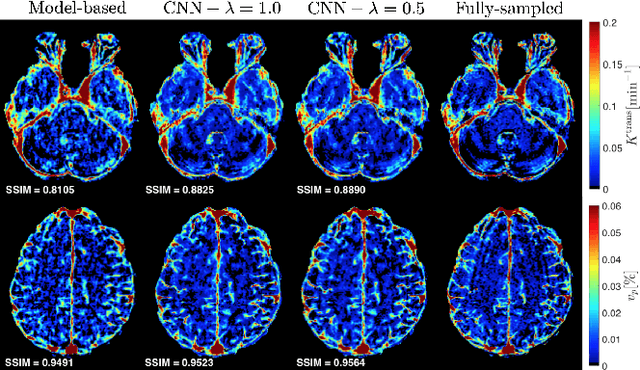 Figure 4 for Direct Estimation of Pharmacokinetic Parameters from DCE-MRI using Deep CNN with Forward Physical Model Loss