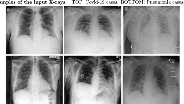 Figure 3 for Deep Learning Models May Spuriously Classify Covid-19 from X-ray Images Based on Confounders