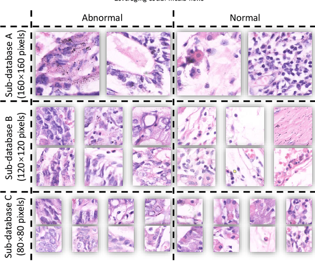 Figure 2 for A Comparative Study of Gastric Histopathology Sub-size Image Classification: from Linear Regression to Visual Transformer