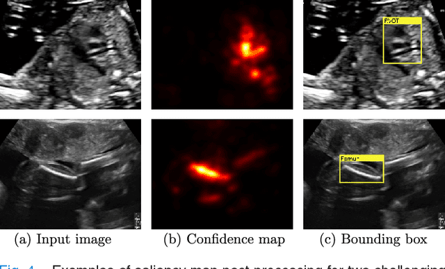 Figure 4 for SonoNet: Real-Time Detection and Localisation of Fetal Standard Scan Planes in Freehand Ultrasound