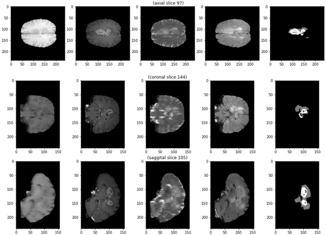 Figure 4 for Convolution Neural Networks for Semantic Segmentation: Application to Small Datasets of Biomedical Images