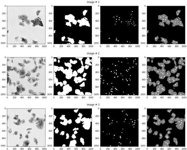 Figure 1 for Convolution Neural Networks for Semantic Segmentation: Application to Small Datasets of Biomedical Images