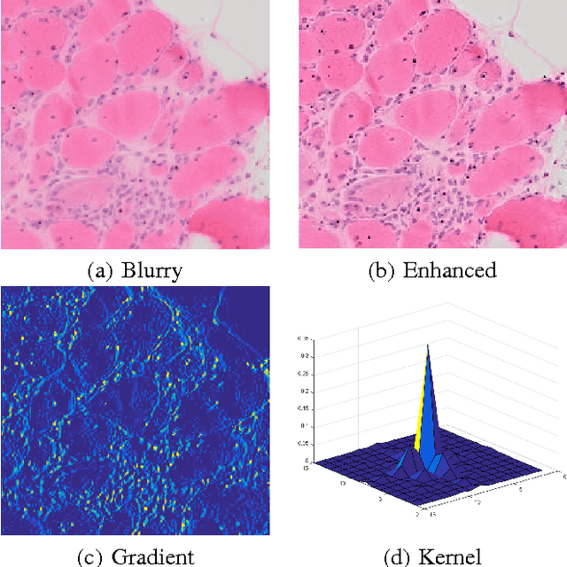 Figure 1 for Microscopic Muscle Image Enhancement