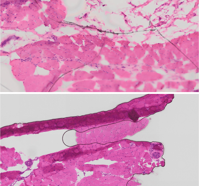 Figure 4 for Microscopic Muscle Image Enhancement