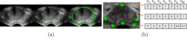 Figure 1 for Deep Adversarial Context-Aware Landmark Detection for Ultrasound Imaging