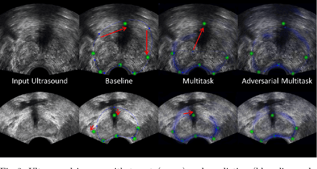 Figure 4 for Deep Adversarial Context-Aware Landmark Detection for Ultrasound Imaging