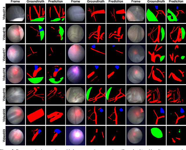Figure 3 for FetReg: Placental Vessel Segmentation and Registration in Fetoscopy Challenge Dataset