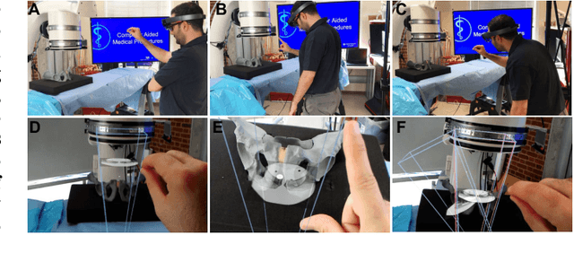 Figure 1 for Spatiotemporal-Aware Augmented Reality: Redefining HCI in Image-Guided Therapy