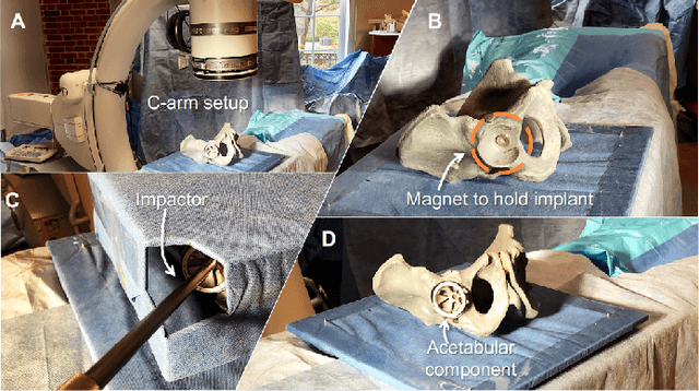Figure 3 for Spatiotemporal-Aware Augmented Reality: Redefining HCI in Image-Guided Therapy