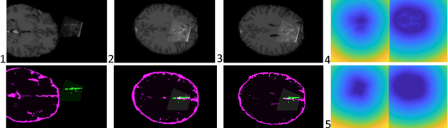 Figure 2 for Initialize globally before acting locally: Enabling Landmark-free 3D US to MRI Registration