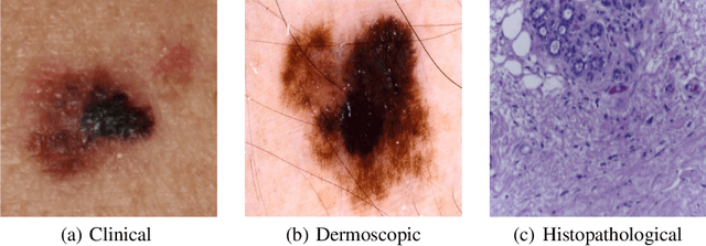 Figure 2 for Recent advances in deep learning applied to skin cancer detection