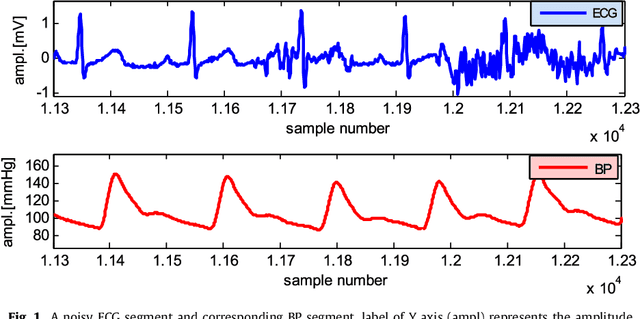 Figure 1 for Robust heartbeat detection using multimodal recordings and ECG quality assessment with signal amplitudes dispersion