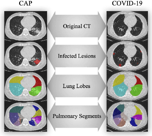 Figure 1 for Hypergraph Learning for Identification of COVID-19 with CT Imaging