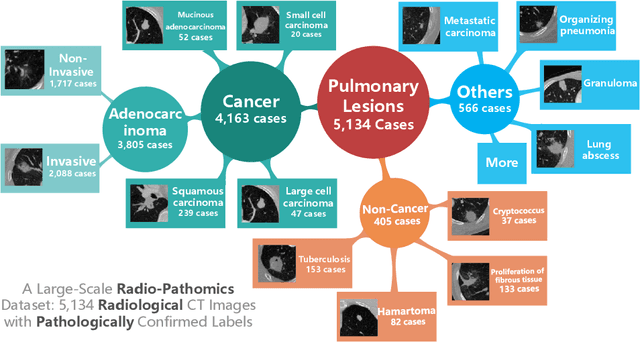 Figure 1 for Hierarchical Classification of Pulmonary Lesions: A Large-Scale Radio-Pathomics Study