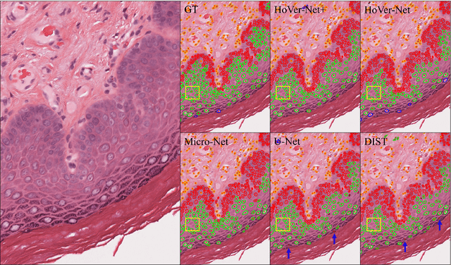 Figure 4 for Simultaneous Nuclear Instance and Layer Segmentation in Oral Epithelial Dysplasia