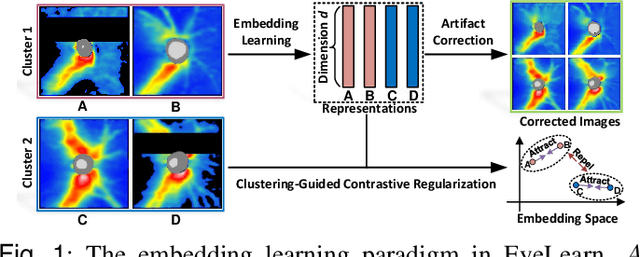 Figure 1 for Artifact-Tolerant Clustering-Guided Contrastive Embedding Learning for Ophthalmic Images
