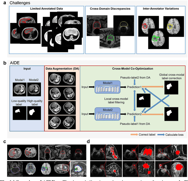 Figure 1 for AIDE: Annotation-efficient deep learning for automatic medical image segmentation