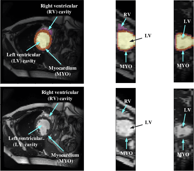 Figure 1 for Myocardial Segmentation of Cardiac MRI Sequences with Temporal Consistency for Coronary Artery Disease Diagnosis