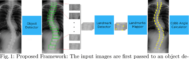Figure 1 for Automatic Cobb Angle Detection using Vertebra Detector and Vertebra Corners Regression