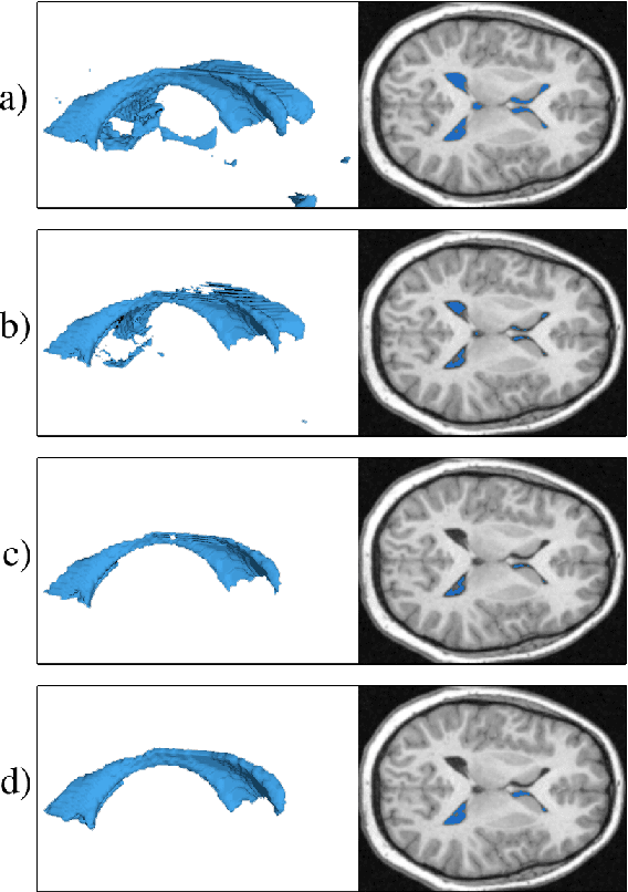 Figure 2 for A Fast, Semi-Automatic Brain Structure Segmentation Algorithm for Magnetic Resonance Imaging