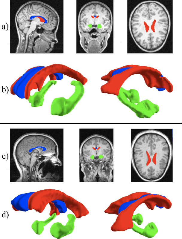 Figure 4 for A Fast, Semi-Automatic Brain Structure Segmentation Algorithm for Magnetic Resonance Imaging