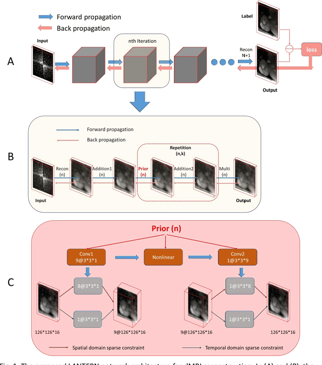 Figure 1 for LANTERN: learn analysis transform network for dynamic magnetic resonance imaging with small dataset