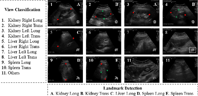 Figure 1 for Less is More: Simultaneous View Classification and Landmark Detection for Abdominal Ultrasound Images