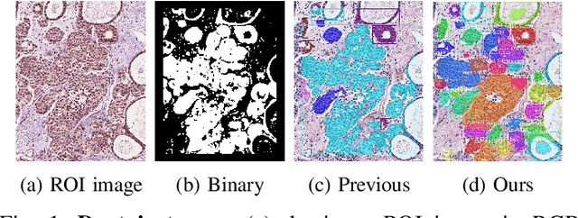Figure 1 for Classifying Breast Histopathology Images with a Ductal Instance-Oriented Pipeline