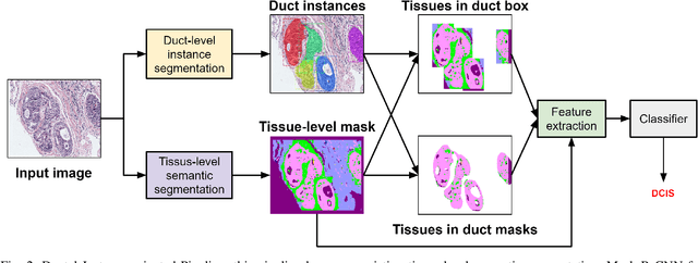 Figure 2 for Classifying Breast Histopathology Images with a Ductal Instance-Oriented Pipeline