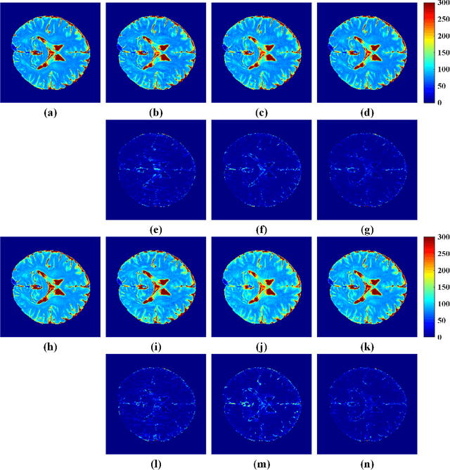 Figure 2 for Accelerated MRI Reconstruction with Separable and Enhanced Low-Rank Hankel Regularization