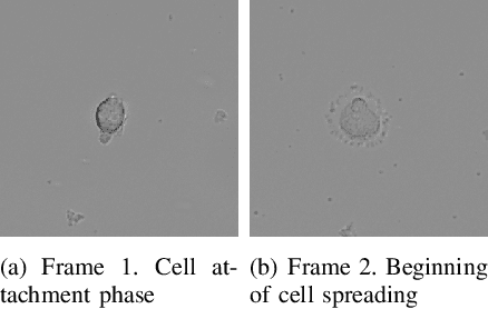 Figure 3 for Automated image segmentation for detecting cell spreading for metastasizing assessments of cancer development