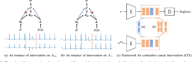 Figure 3 for A Causal Intervention Scheme for Semantic Segmentation of Quasi-periodic Cardiovascular Signals