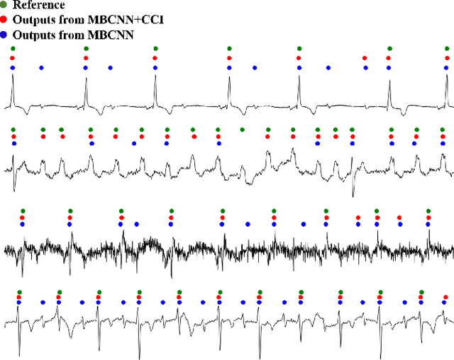 Figure 4 for A Causal Intervention Scheme for Semantic Segmentation of Quasi-periodic Cardiovascular Signals